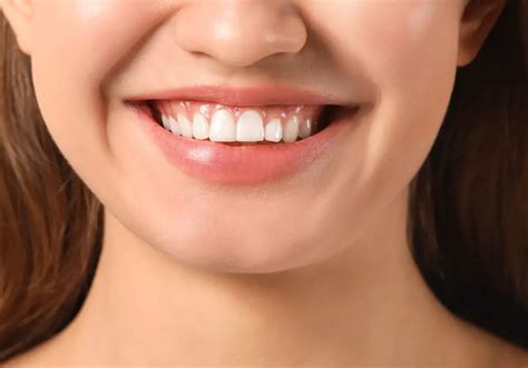 Can Gums Heal Over Food: Exploring the Intricacies of Oral Health and Nutrition